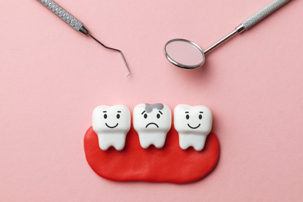 5 Signs You Might Have a Cavity – When to Visit a Dentist in Miami