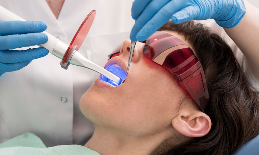 Considering teeth whitening in Miami? Discover the best treatment options, safety tips, and how to choose between whitening and veneers. Book a consultation at Honest Dental Services.